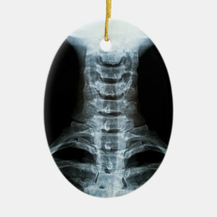 Digital X-Ray Art (Custom Back Text) Ceramic Tree Decoration
