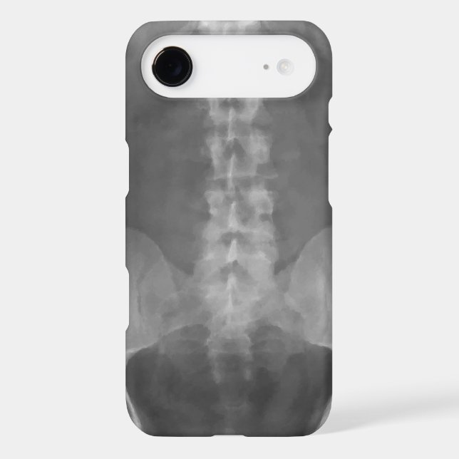 Digital X-Ray Art iPhone 5 Case (Back)