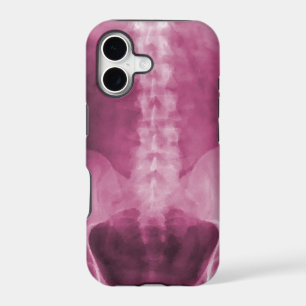 Digital X-Ray Art iPhone 5 Case
