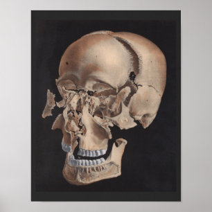 Disarticulated Exploded Skull Print