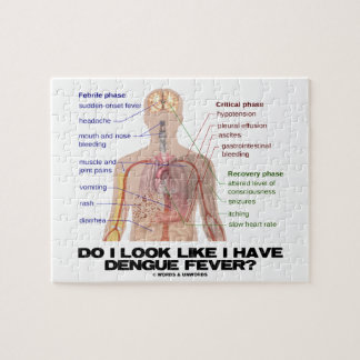 Do I Look Like I Have Dengue Fever (Anatomy) Jigsaw Puzzle