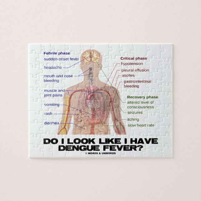 Do I Look Like I Have Dengue Fever (Anatomy) Jigsaw Puzzle (Horizontal)