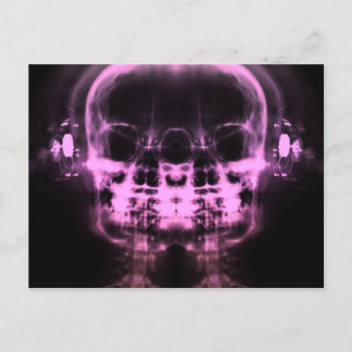 Double X-Ray Skulls with Headphones - Pink Postcard