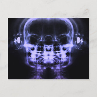 Double X-Ray Skulls with Headphones - Purple  Postcard