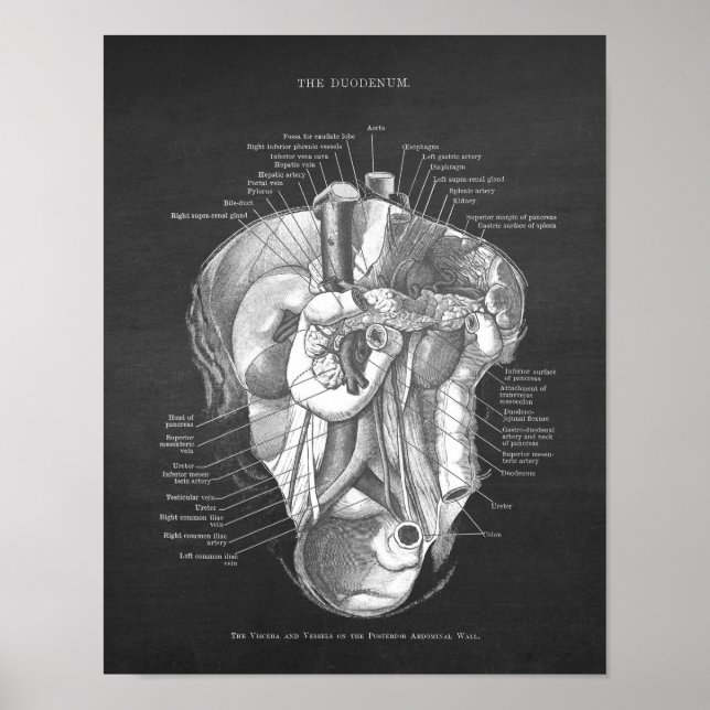 Duodenum Anatomy Art Gastroenterologist Wall Decor (Front)