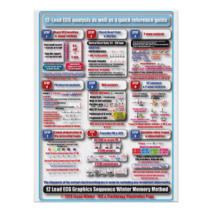 ECG Training Poster