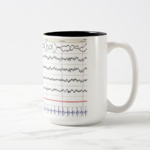 EEG Mug - REM Sleep