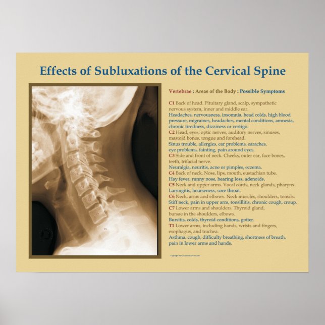 Effects of Cervical Spinal Subluxation Poster (Front)