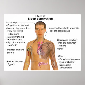 Effects of Sleep Deprivation on the Human Body Poster