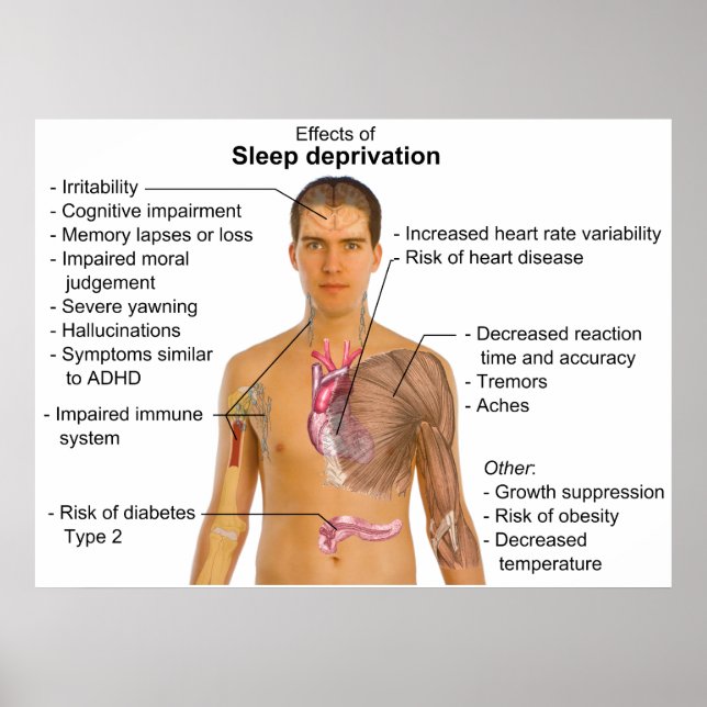 Effects of Sleep Deprivation on the Human Body Poster (Front)