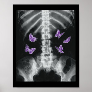 Egirl Xray Skeleton Pink Butterfly Harajuku Y2k Da Poster
