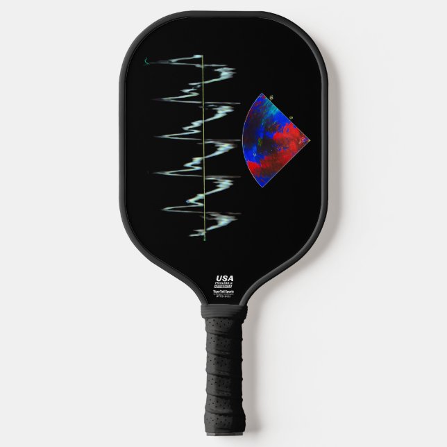 EKG and echocardiogram pickleball paddle (Front)