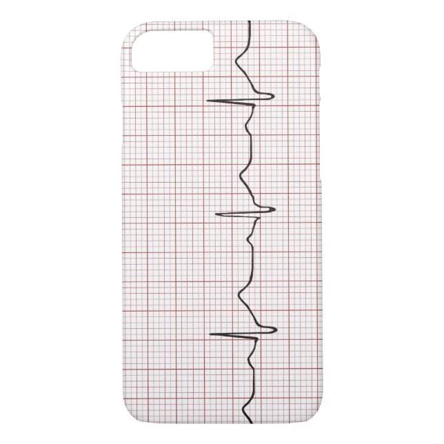 EKG heartbeat on graph paper, PhD (doctor) pulse Case-Mate iPhone Case (Back)