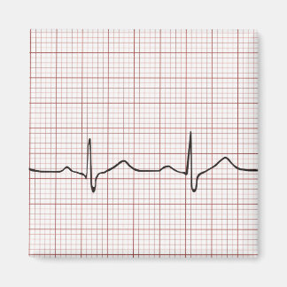 EKG heartbeat on graph paper, PhD (doctor) pulse Magnet