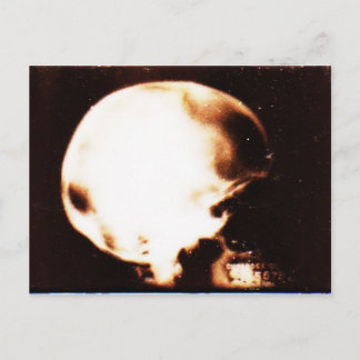 Emptyheaded Postcard