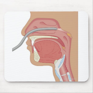 Endoscopy of the Nose Mouse Mat
