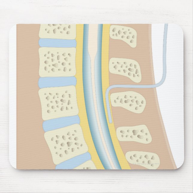 Epidural Anaesthesia Mouse Mat (Front)