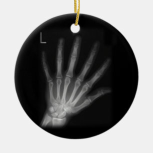 Extra Digit X-ray Left Hand Ceramic Tree Decoration