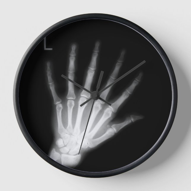 Extra Digit X-ray Left Hand Clock (Front)
