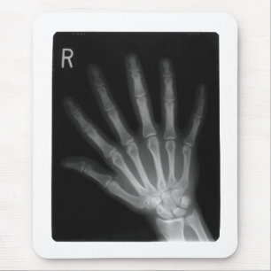 Extra Digit X-ray Right Hand Mouse Mat