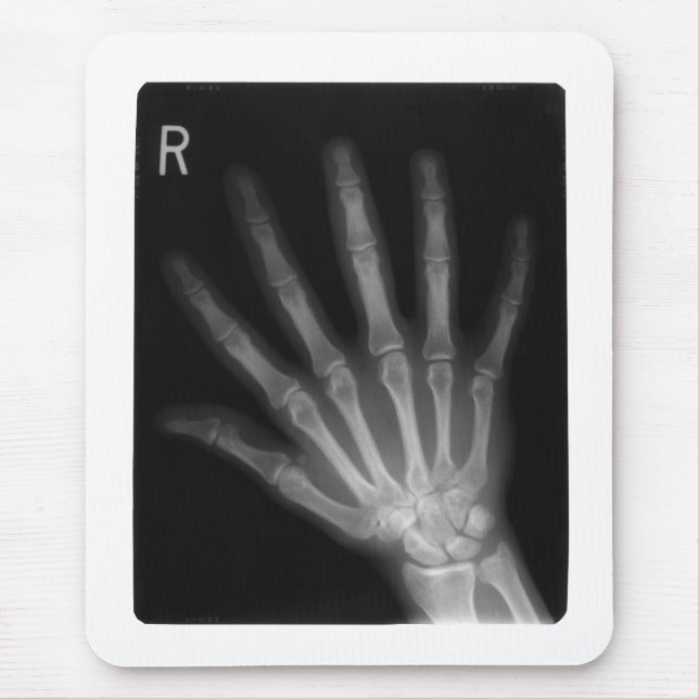 Extra Digit X-ray Right Hand Mouse Mat (Front)