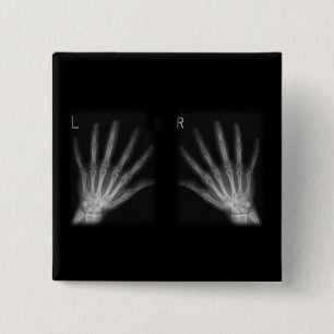 Extra Digit X-ray Right & Left Hands 15 Cm Square Badge