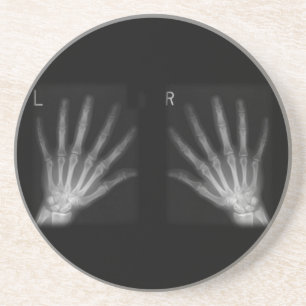 Extra Digit X-ray Right & Left Hands Coaster