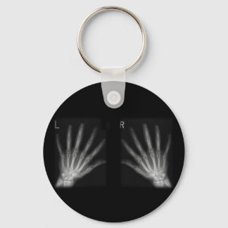 Extra Digit X-ray Right & Left Hands Key Ring