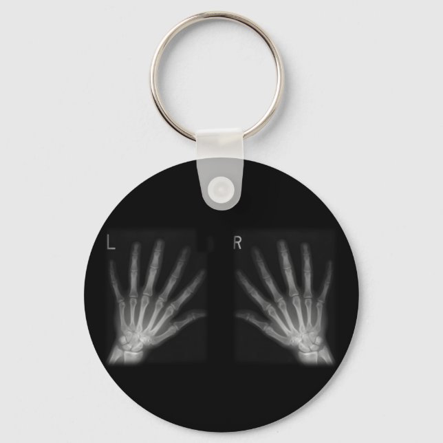 Extra Digit X-ray Right & Left Hands Key Ring (Front)