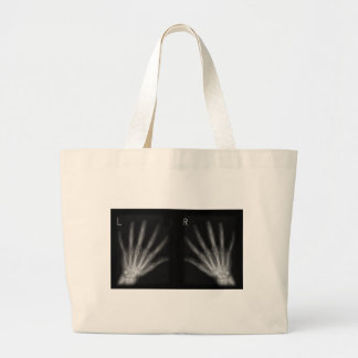 Extra Digit X-ray Right & Left Hands Large Tote Bag