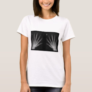 Extra Digit X-ray Right & Left Hands T-Shirt