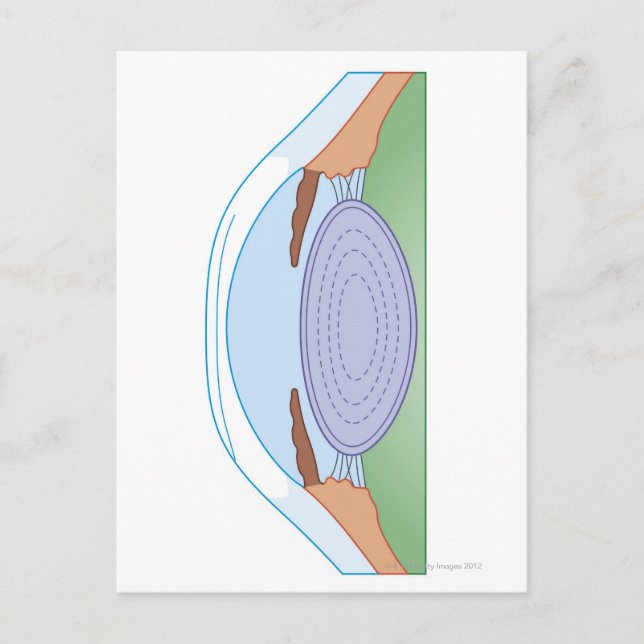 Eye After Corrective Surgery Postcard (Front)