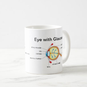 Eye Diagram for Glaucoma and Healthy Eye Coffee Mug