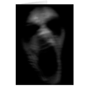 Falln Mental Disturbances