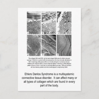 Faulty Collagen EDS Awareness Postcard