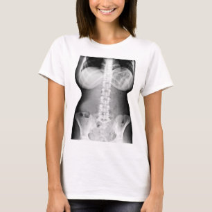 Female Body Xray Skeleton Photo image T-Shirt