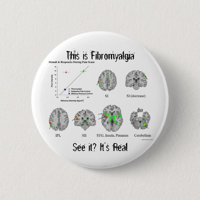 Fibromyalgia is real. fMRI proof 6 Cm Round Badge (Front)