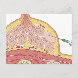 Fine Needle Aspiration Postcard