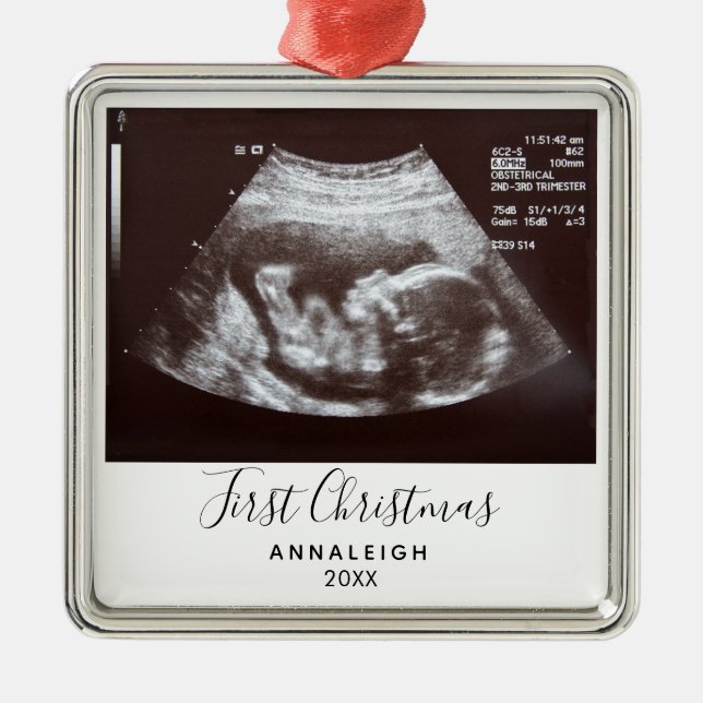 First Christmas Pregnancy Ultrasound Photo Custom Metal Tree Decoration (Front)