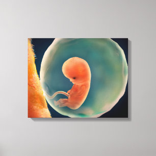 Foetus Development At 9 Weeks Canvas Print