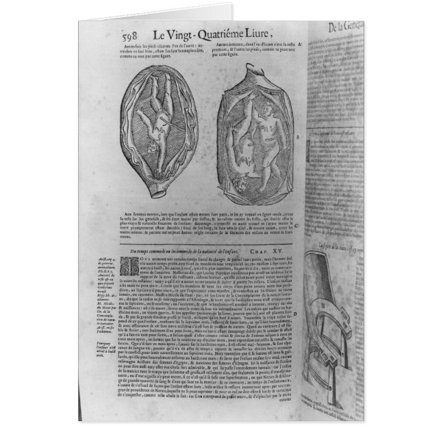 Foetus, illustration from 'Oeuvres' (Front)