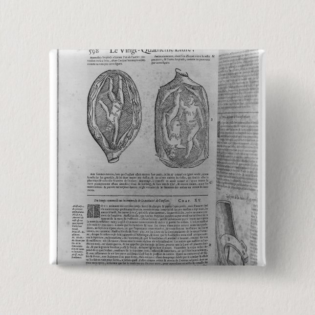 Foetus, illustration from 'Oeuvres' 15 Cm Square Badge (Front)