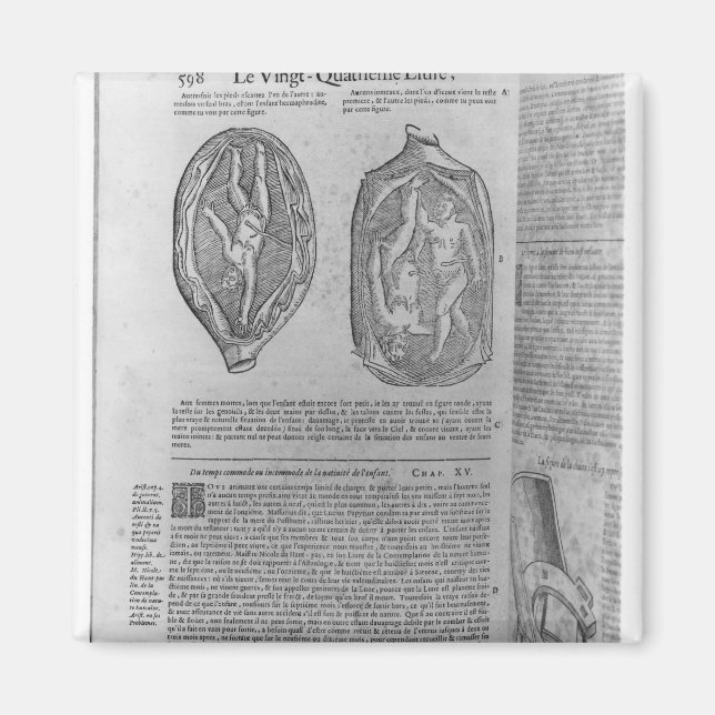 Foetus, illustration from 'Oeuvres' Magnet (Front)
