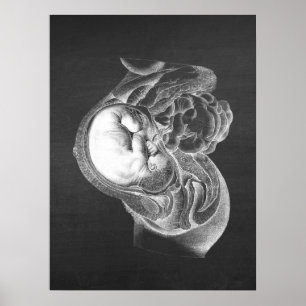 Foetus Womb Anatomy Obstetrics Decor no. 2