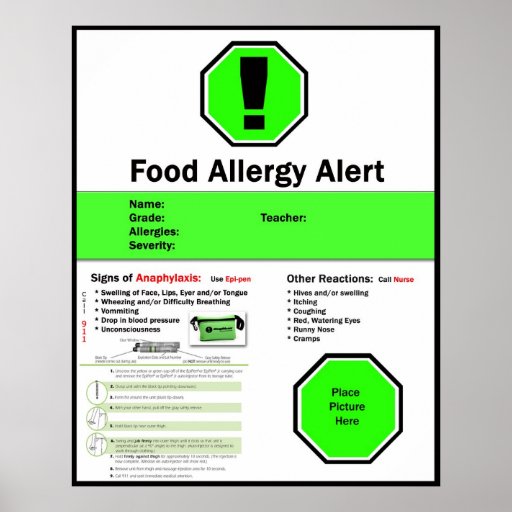 Food Allergy Poster for School | Zazzle.co.uk