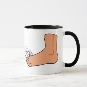 Foot-2 Broken Toe Mug