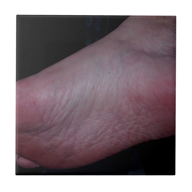 FOOT DOMME TILE (Front)