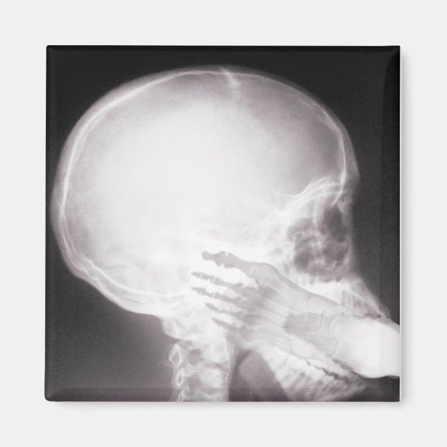 Foot in Mouth X-Ray Magnet (Front)