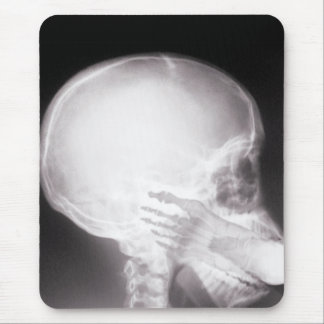 Foot in Mouth X-Ray Mouse Mat