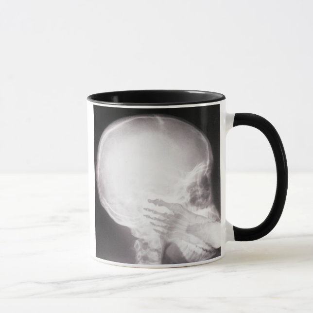 Foot in Mouth X-Ray Mug (Right)